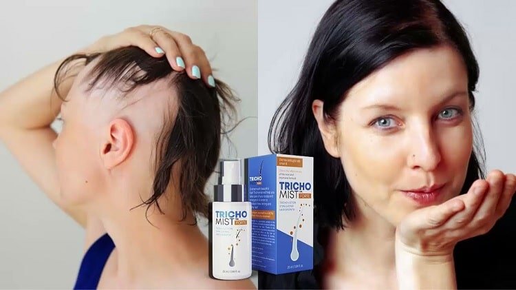 Odkryj Skuteczne Wykorzystanie Trichomist Forte w Rozwiązywaniu Problemów in Poland